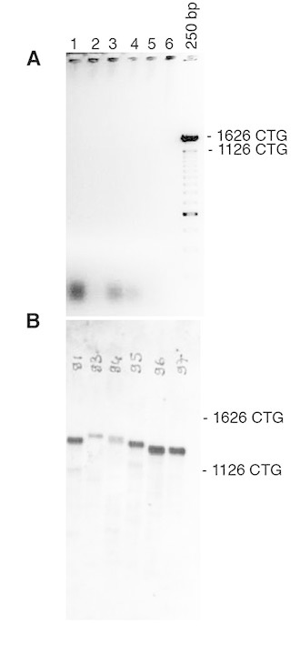 Detection of CTG repeat length in tail DNA from DM1 mice carrying a large fragment of human genomic DNA, comprising 45kb of the DM1 locus and more than 1200 of CTG repeats in the mouse genome (Gomes-Pereira et al, 2007).