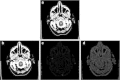 Fig. 1