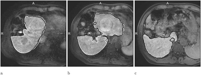 Fig 9