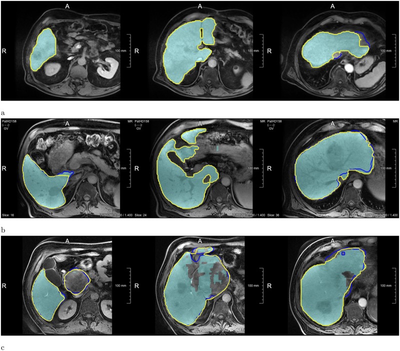 Fig 6