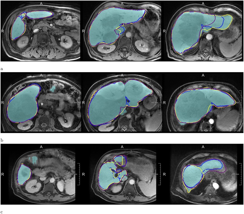 Fig 4