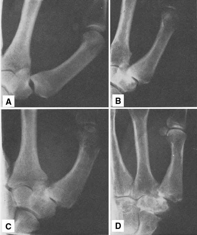 Fig. 1A–D