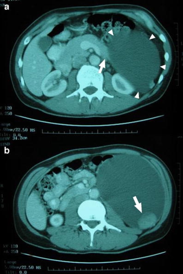 Fig. 1