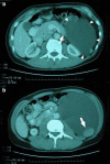 Fig. 1