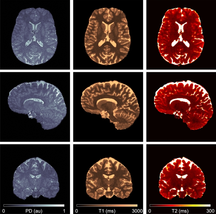 Figure 12