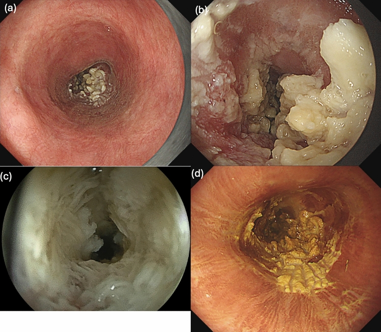 Fig. 3