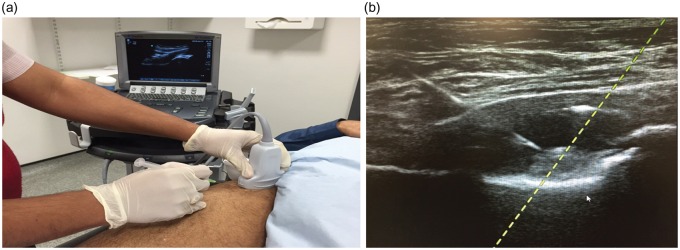 Figure 6.