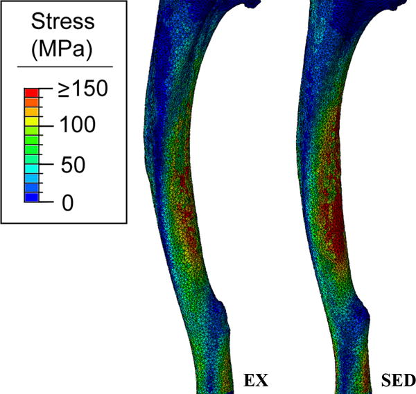 Ibuprofen Before Exercise Does Not Prevent Cortical Bone Adaptations To ibuprofen-before-exercise-does-not-prevent-cortical-bone-adaptations-to