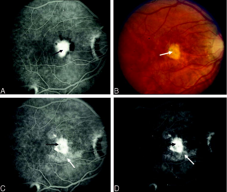 Fig. 13