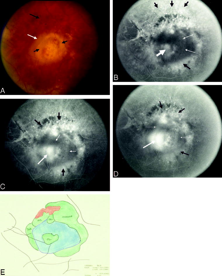 Fig. 3