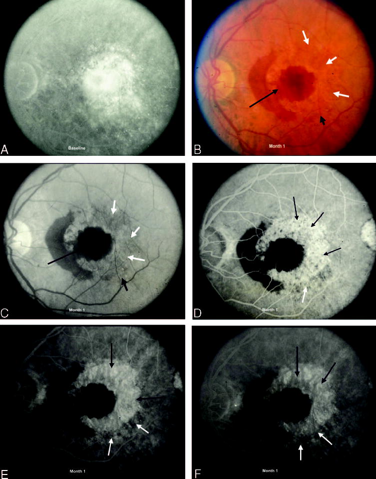 Fig. 12