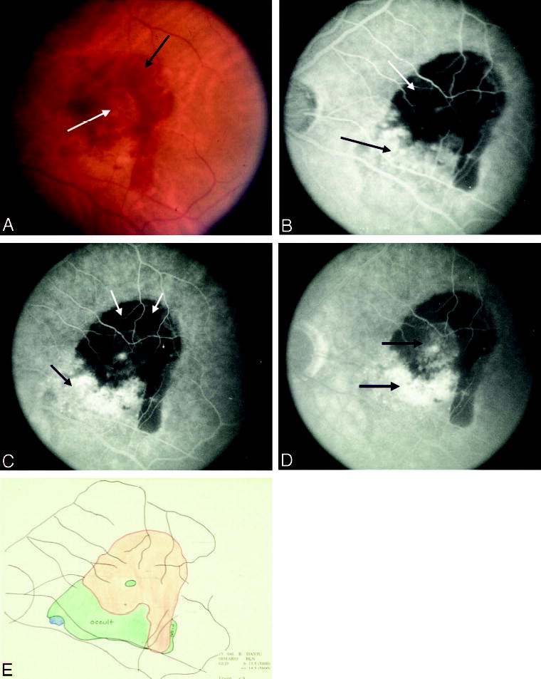 Fig. 10