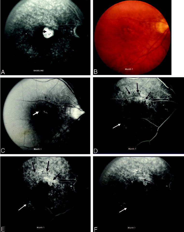 Fig. 11