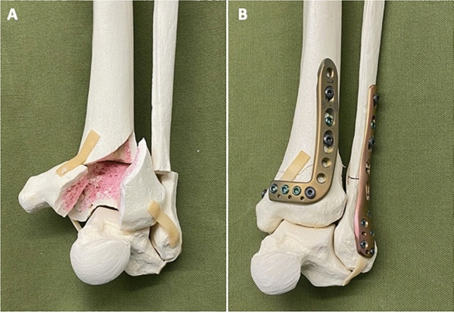 Fig. 1