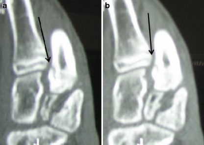 Fig. 2