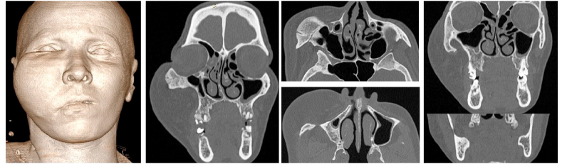 Fig. 2