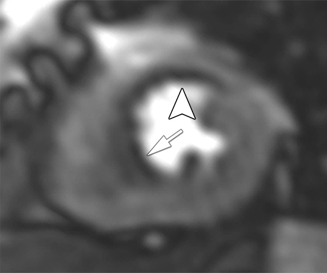 Figure 2b: