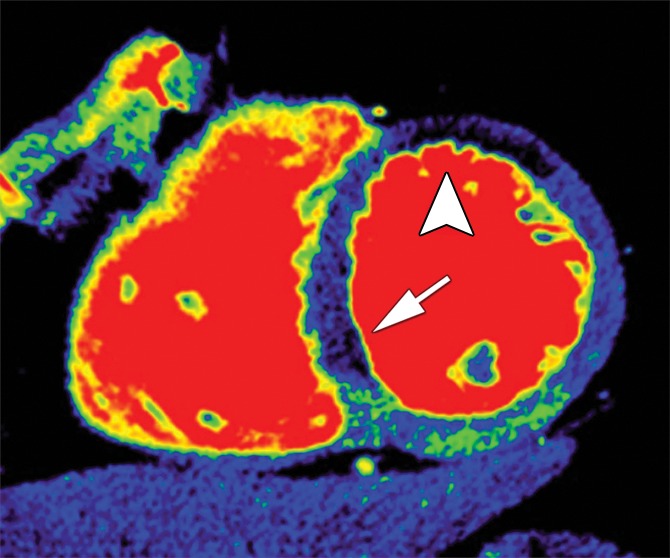 Figure 2a: