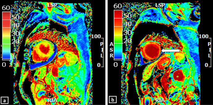 Figure 12.