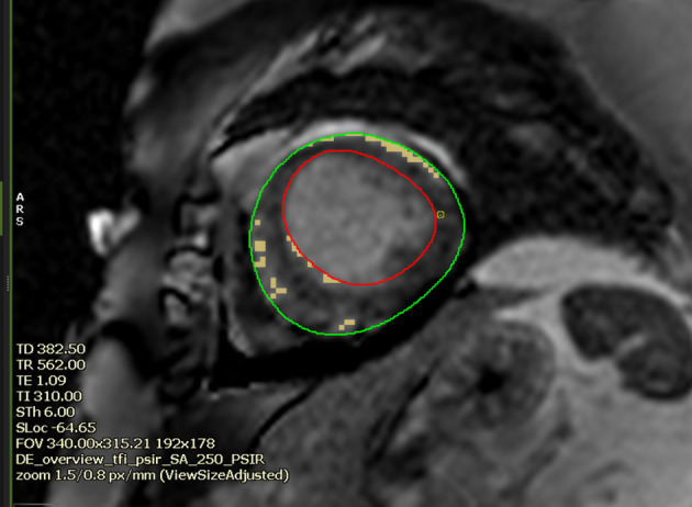 Figure 10.