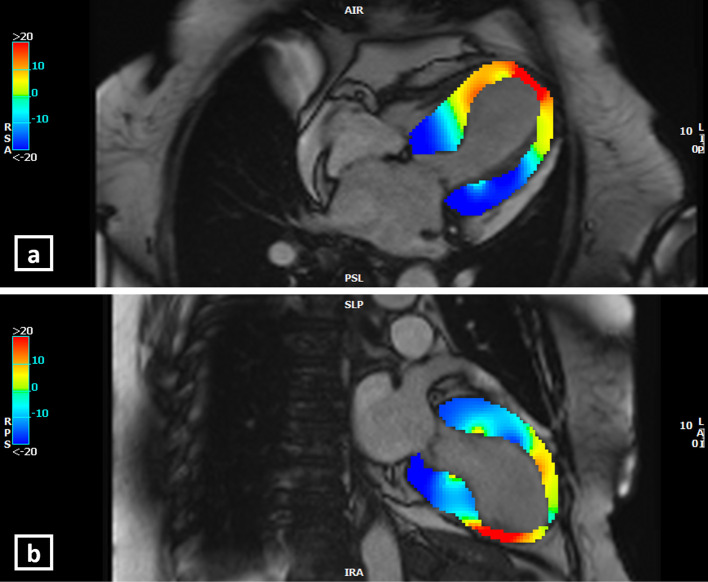 Figure 6.