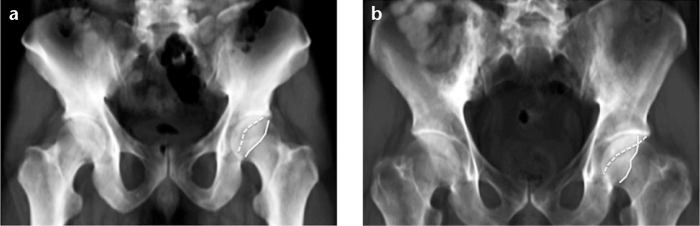 Figure 7. a, b.