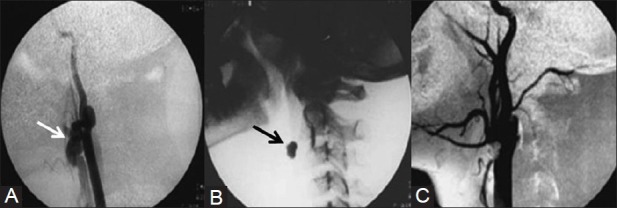 Figure 16 (A-C)