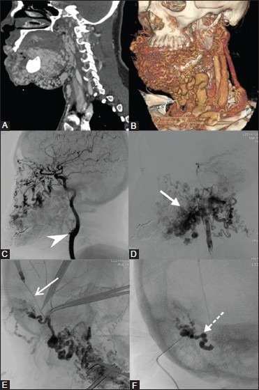 Figure 3(A-F)