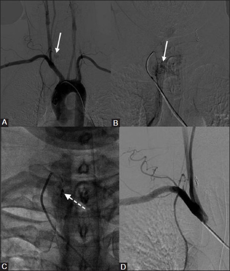 Figure 9(A-D)