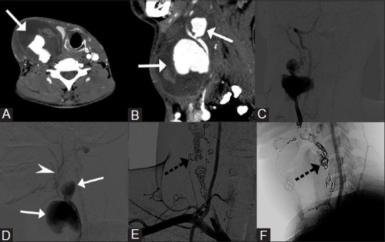 Figure 15(A-D)