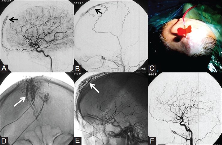 Figure 2 (A-F)