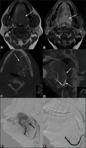 Figure 10(A-F)