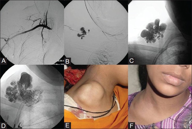 Figure 1 (A-F)