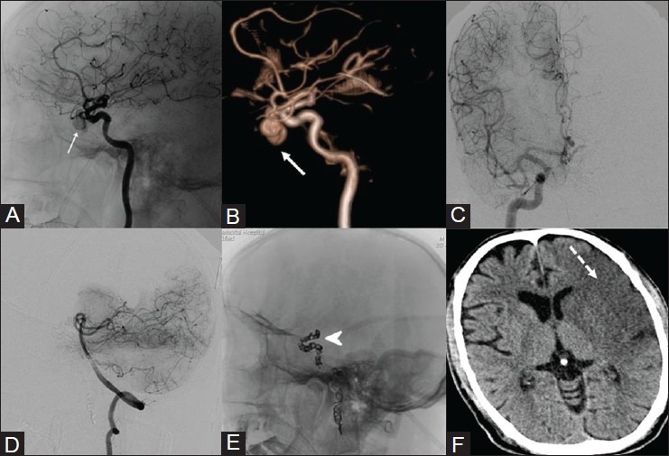 Figure 14(A-F)