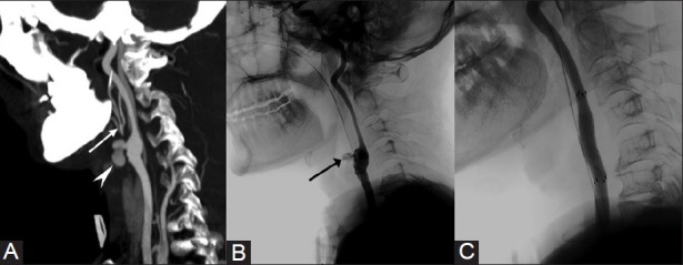 Figure 12 (A-C)