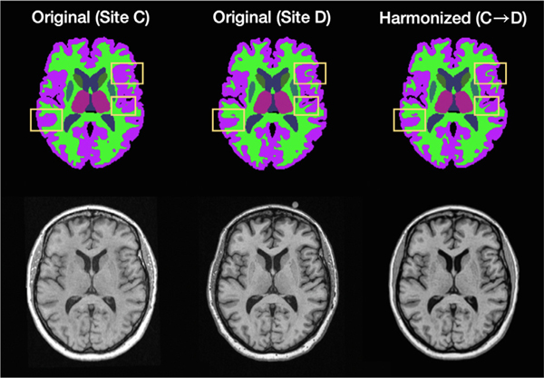 Fig. 11.