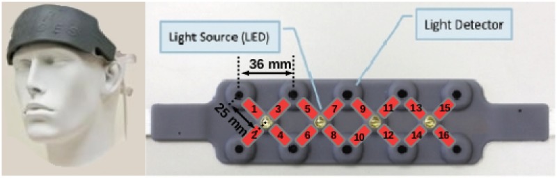 Fig 1