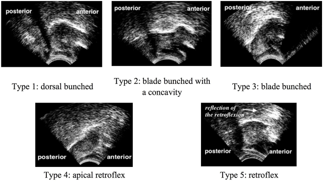 Figure 2: