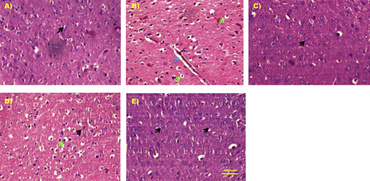 Figure 4