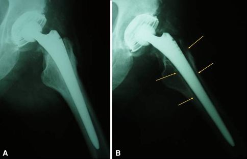 Fig. 6A–B