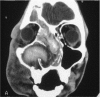 Fig 5