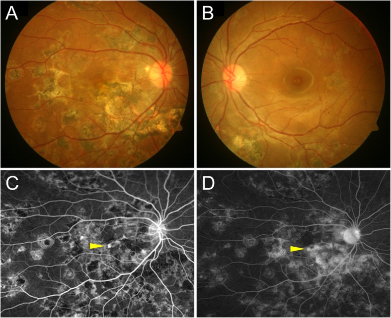 Fig. 1