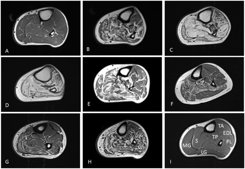 Fig. 2