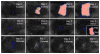 Fig. 13