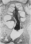 384-1