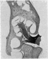 386-1