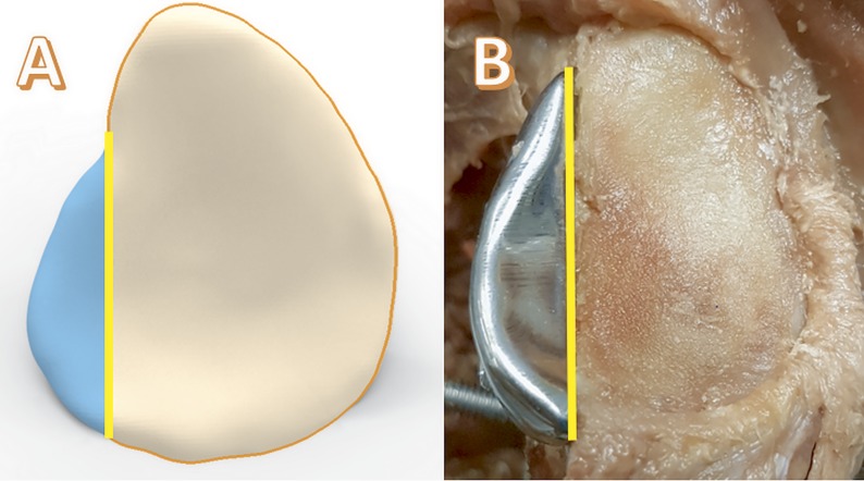 Fig. 3