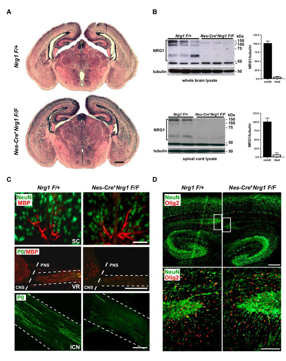 Neuregulin-1/ErbB signaling serves distinct functions in myelination of ...