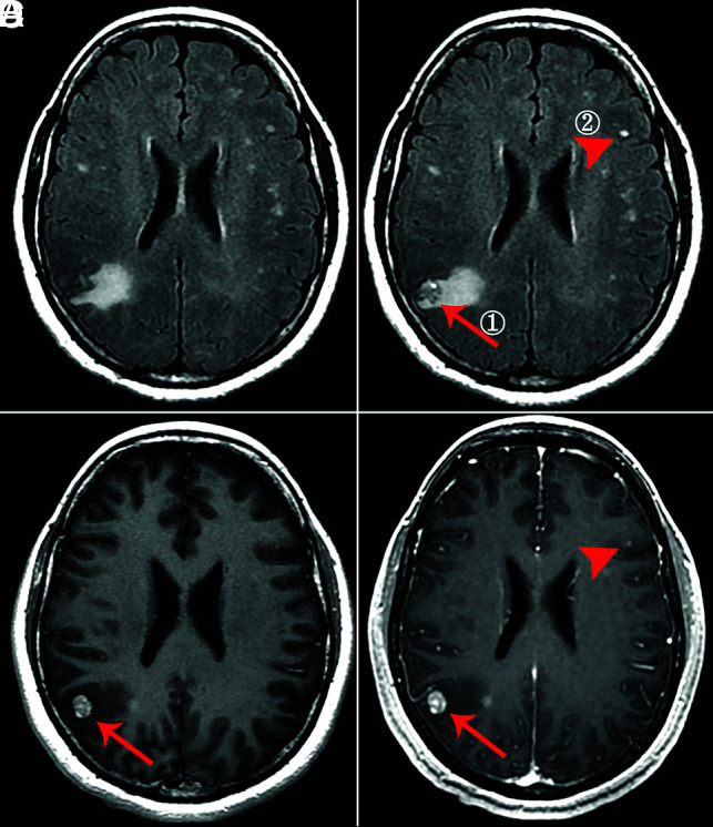 FIG 4.