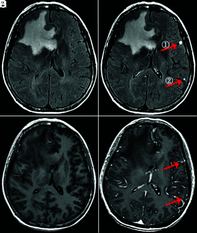 FIG 6.